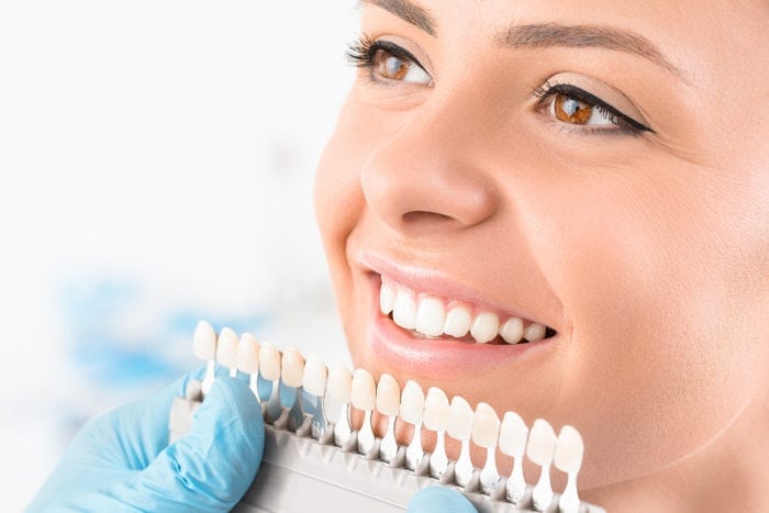 DC Precision Dentistry offers Professional teeth whitening in Washington DC