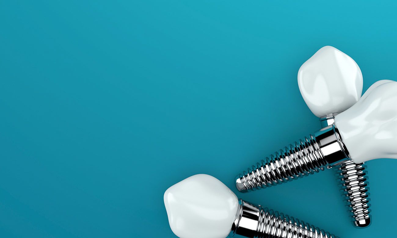 Dental Implants Encourage Bone Regrowth Dentist in Washington, DC